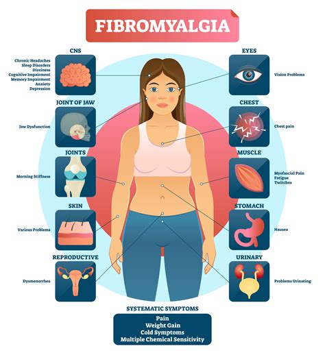 Fibromyalgia